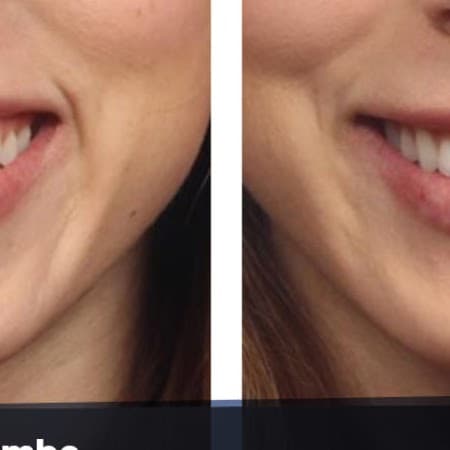 Erce Beleçoğlu - Dental Clinic