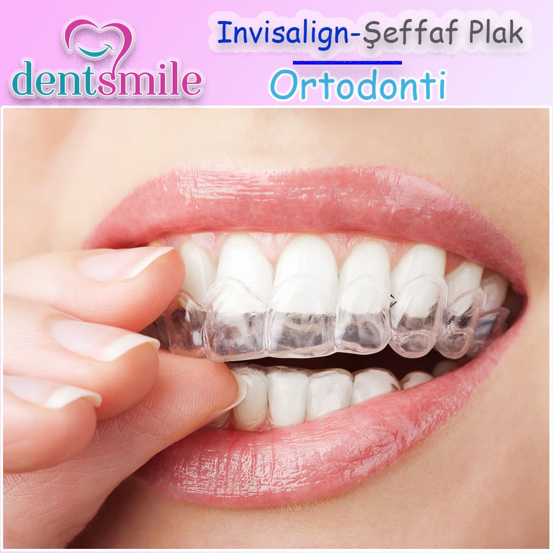 Dent Smile Dental Clinic