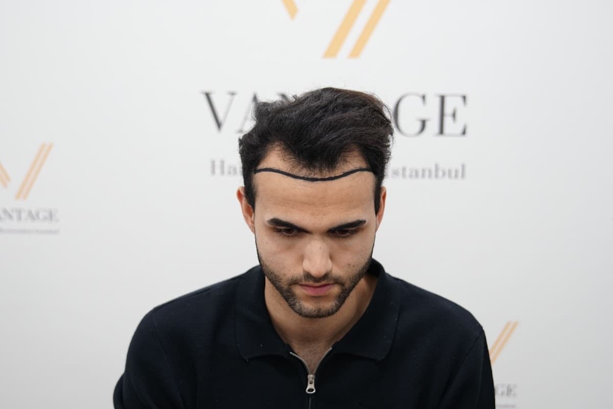 Vantage Clinic Turkey