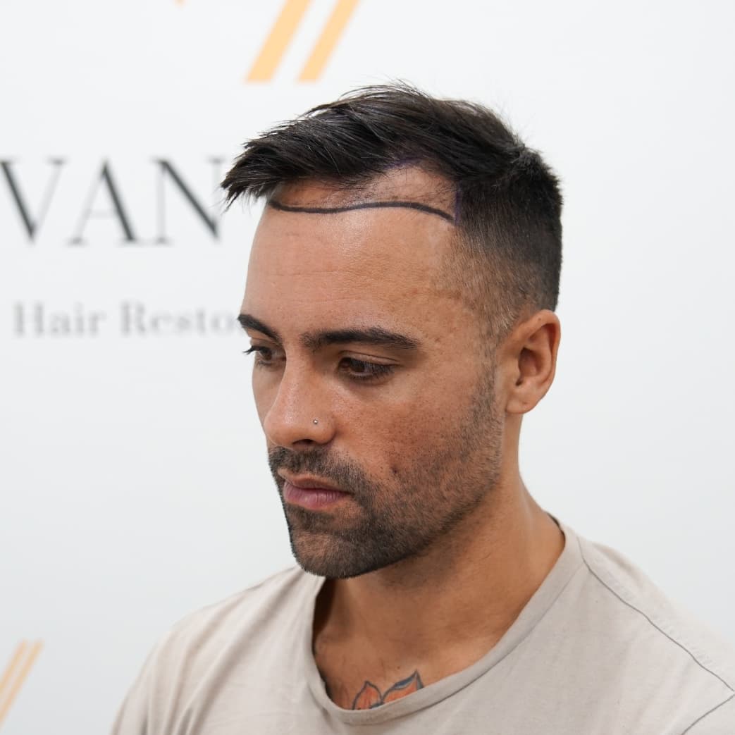 Vantage Clinic Turkey