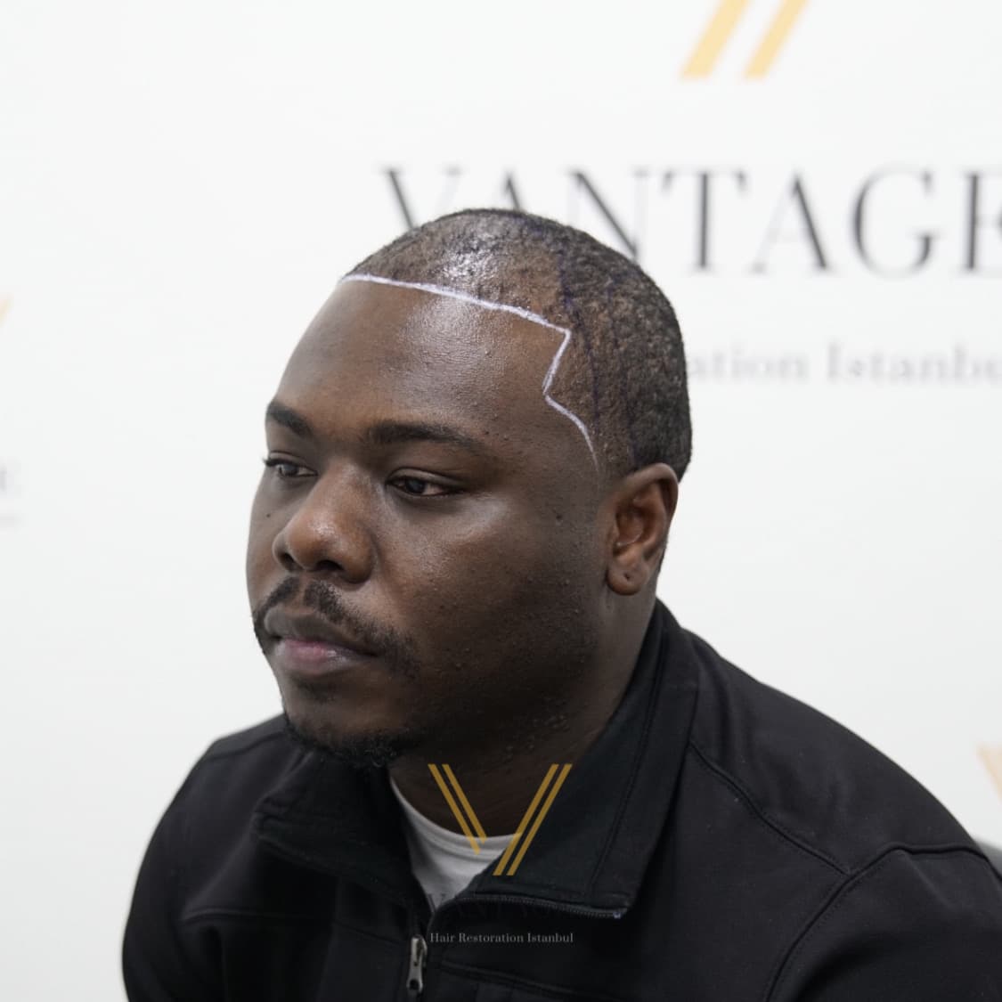 Vantage Clinic Turkey