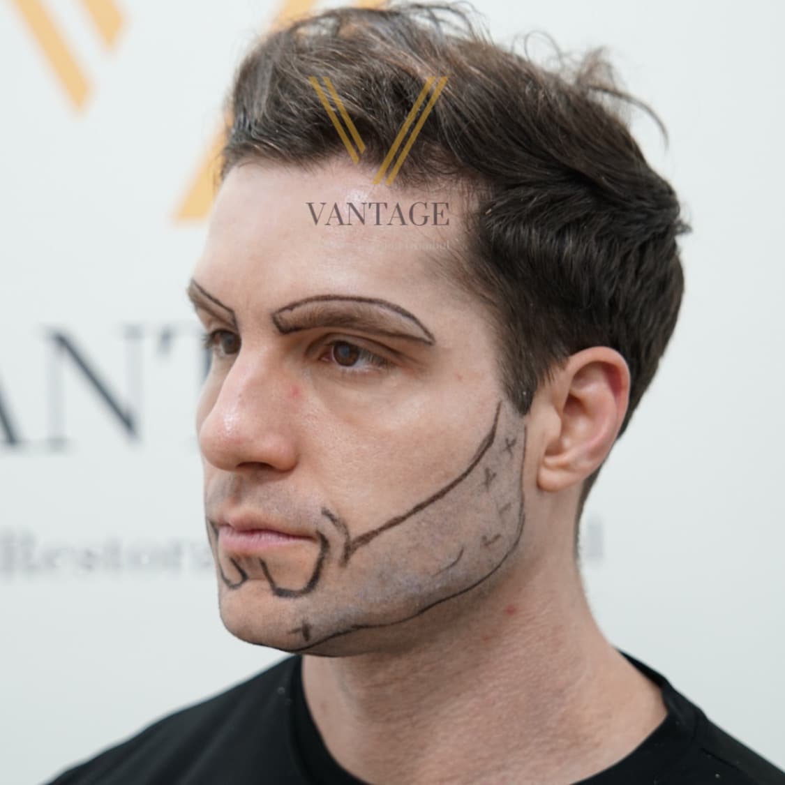 Vantage Clinic Turkey