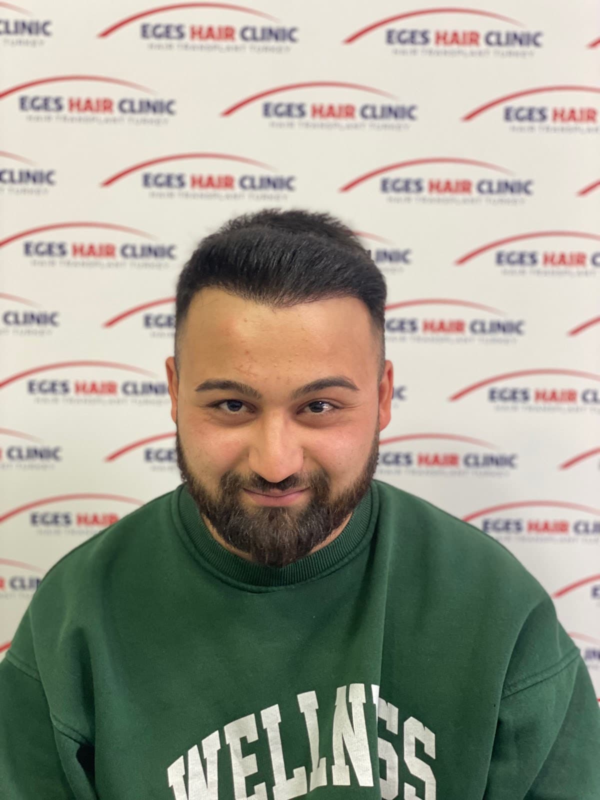 İzmir Saç Ekim Merkezi | Eges Hair Clinic