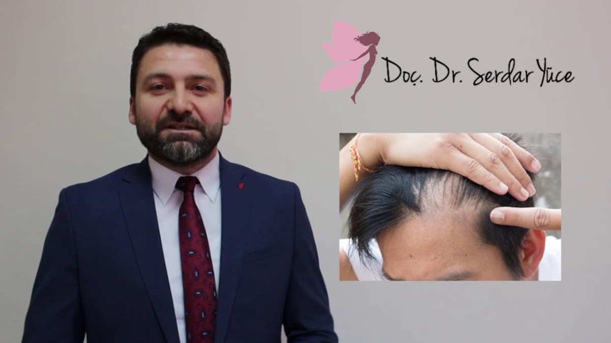 Burun Estetiği Doç.Dr.Serdar YÜCE