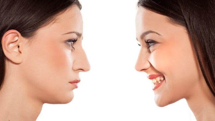 Burun Estetiği Doç.Dr.Serdar YÜCE