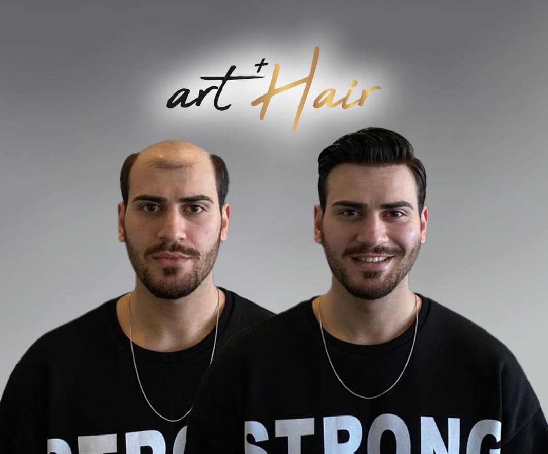 Art Plus Hair - İzmir Protez Saç
