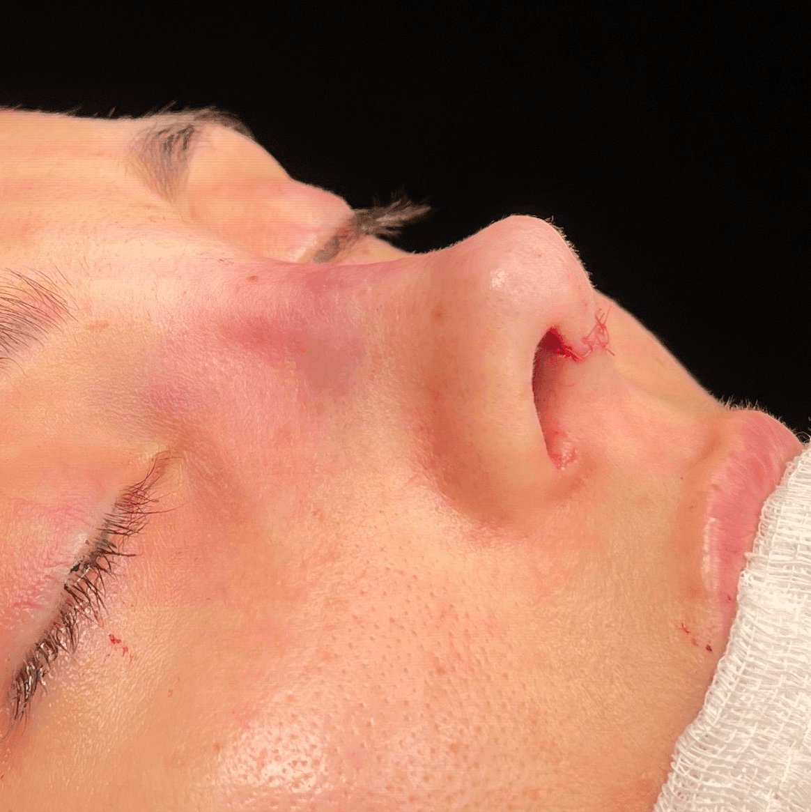 Estetik ve Plastik Cerrahi Merkezi - Esteaura