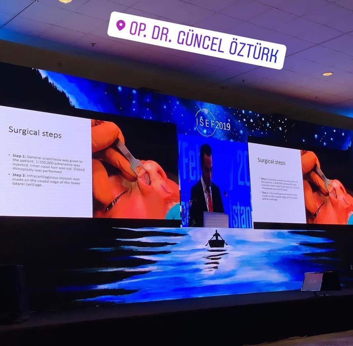 Rhinoplasty Turkey I Assoc. Prof. Dr. Güncel Öztürk