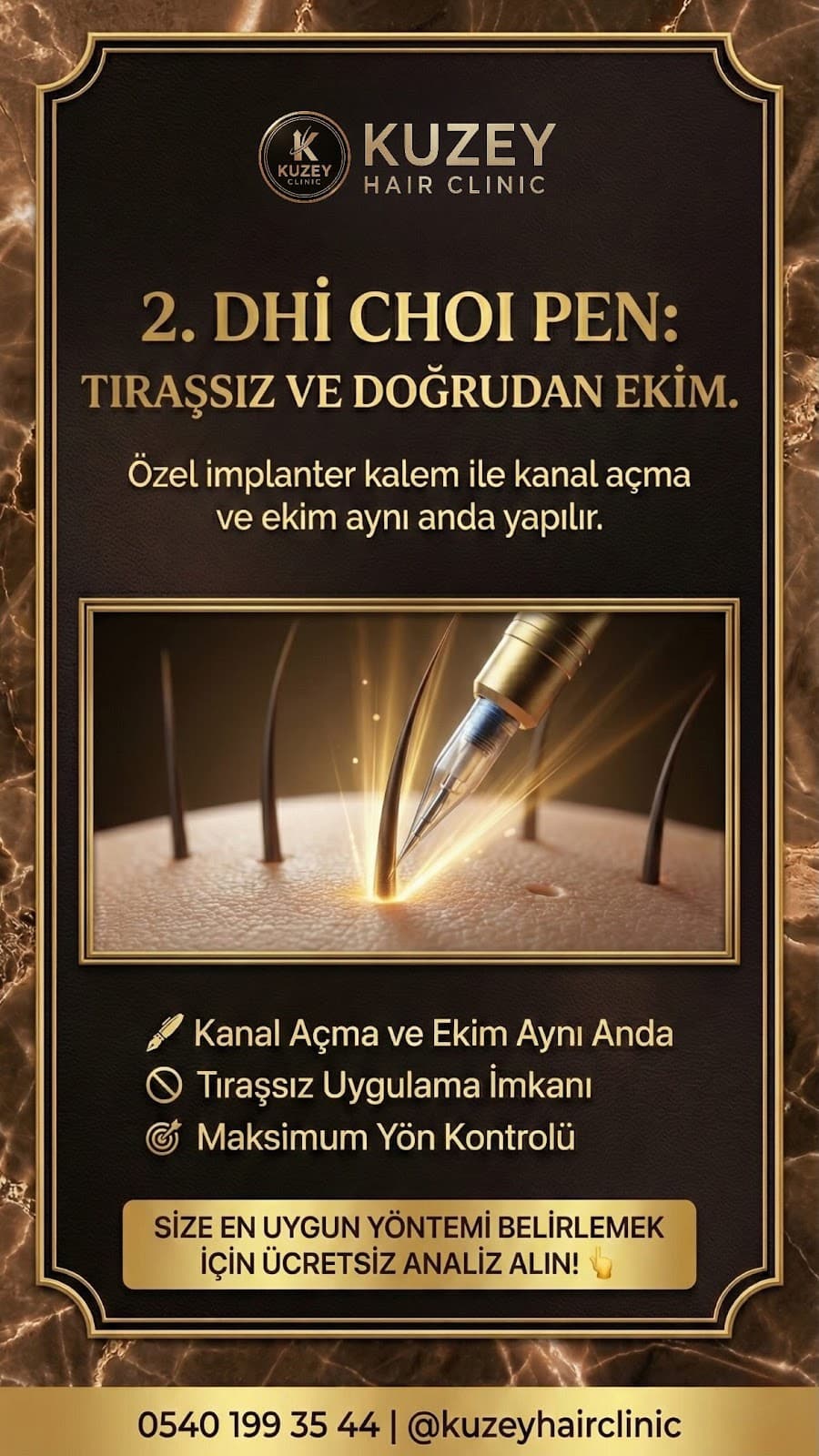 İzmir Saç Ekim Merkezi | Kuzey Hair Clinic