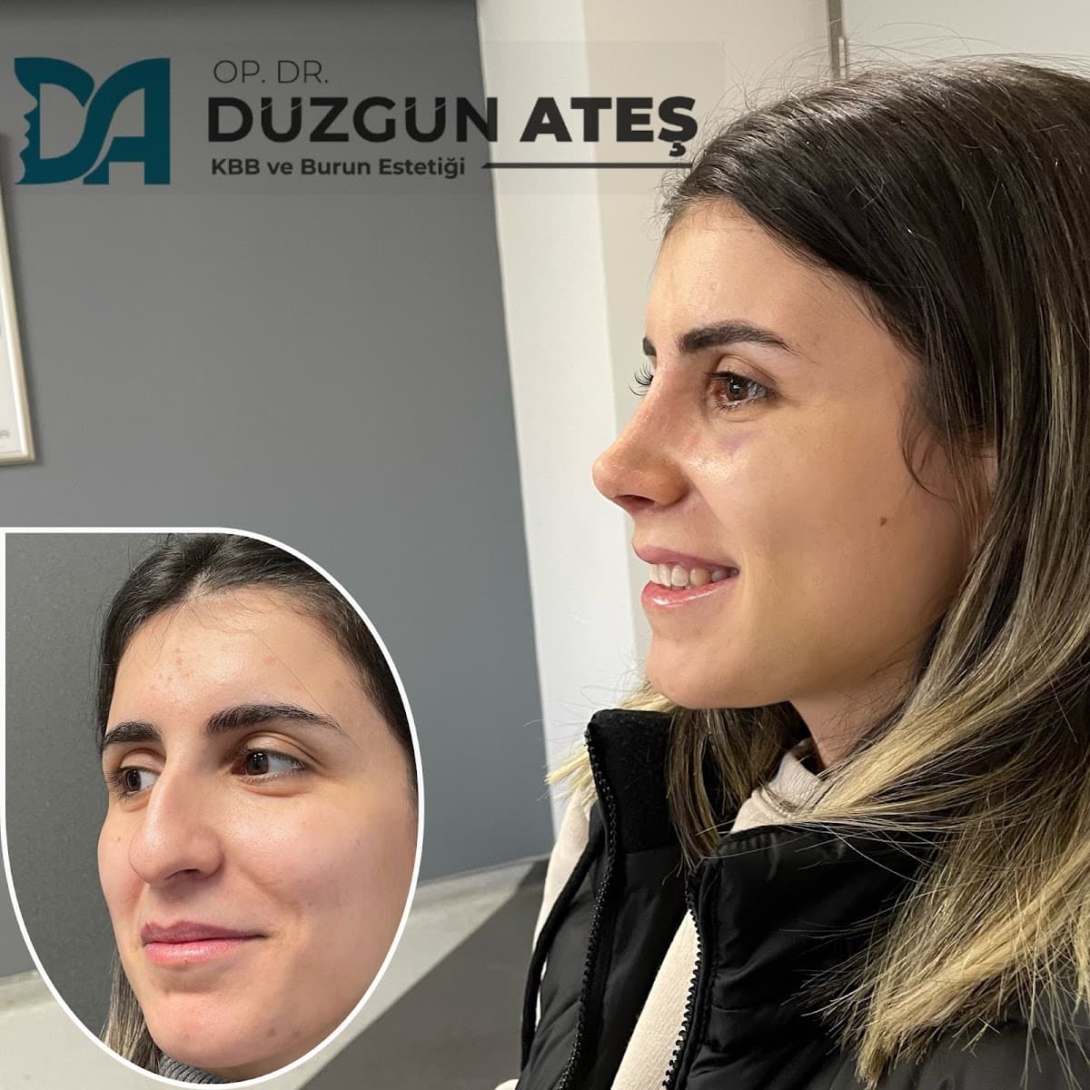 Op. Dr. Düzgün Ateş