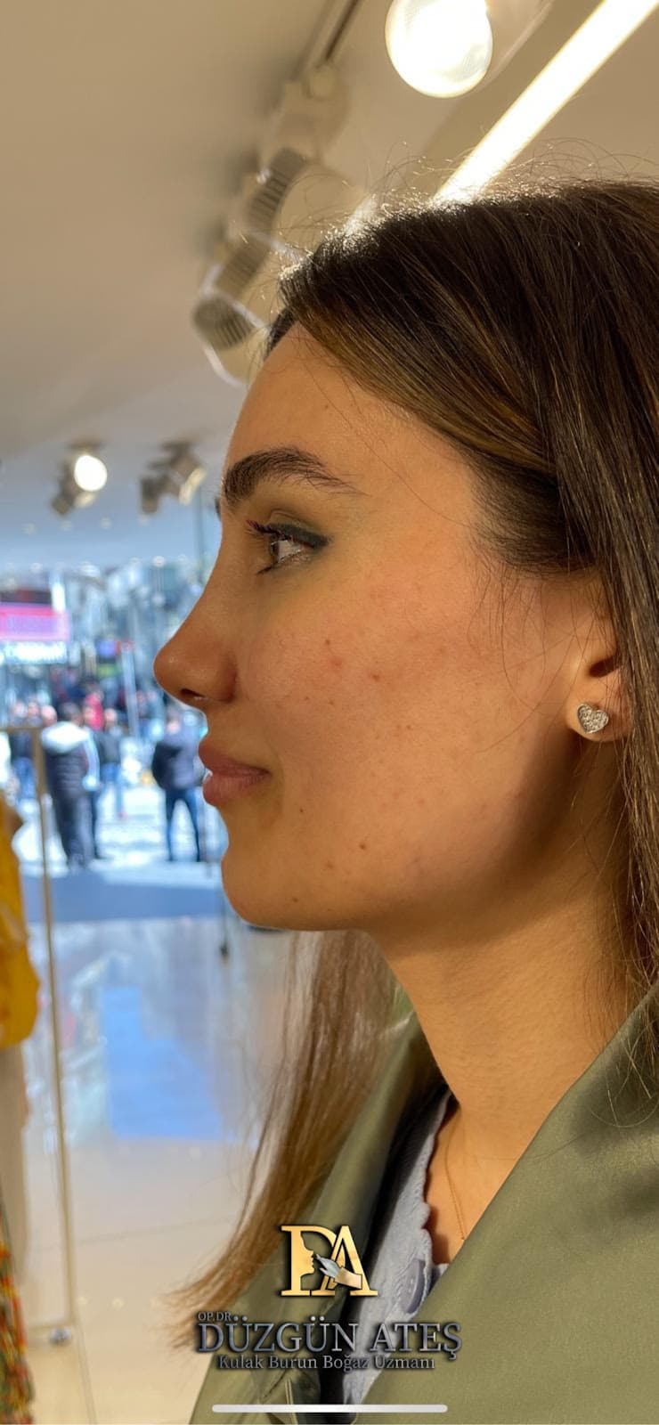 Op. Dr. Düzgün Ateş