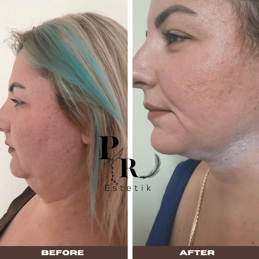 Op Dr. Pinarerogluulusoy