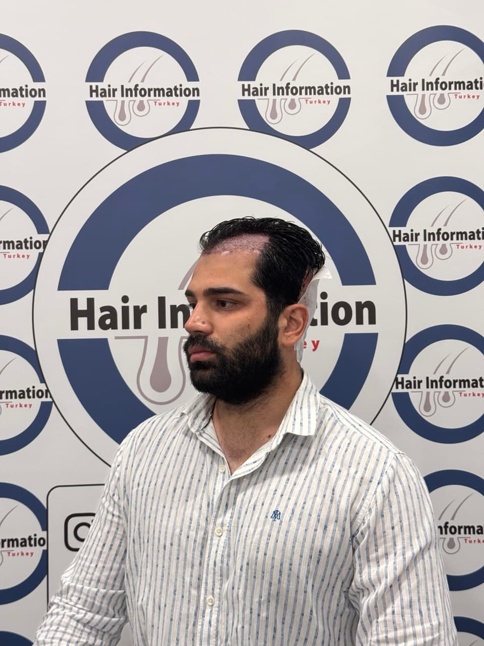 Hair Information Clinic - Saç Ekimi