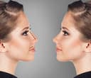 Istanbul Plastic Surgery Support - ( Vaser Liposuction, Nose Job, Tummy Tuck, BBL, Facelift, Implants, Laser, Lip Lift, Gynecomastia)