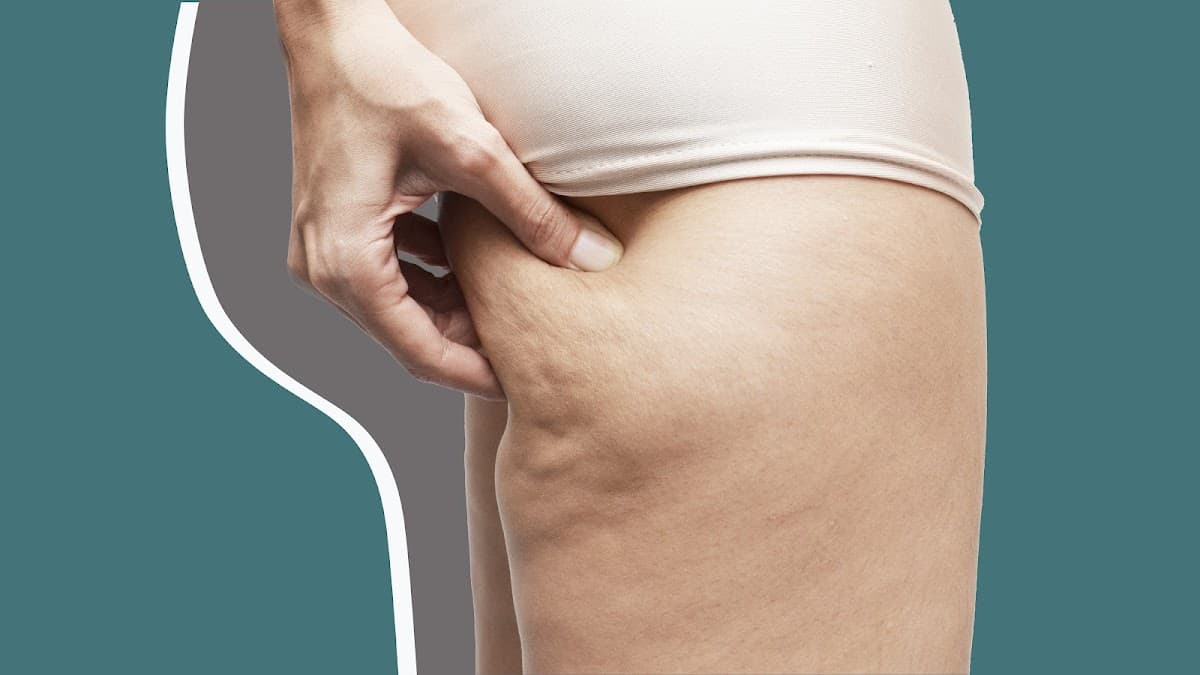 Istanbul Plastic Surgery Support - ( Vaser Liposuction, Nose Job, Tummy Tuck, BBL, Facelift, Implants, Laser, Lip Lift, Gynecomastia)