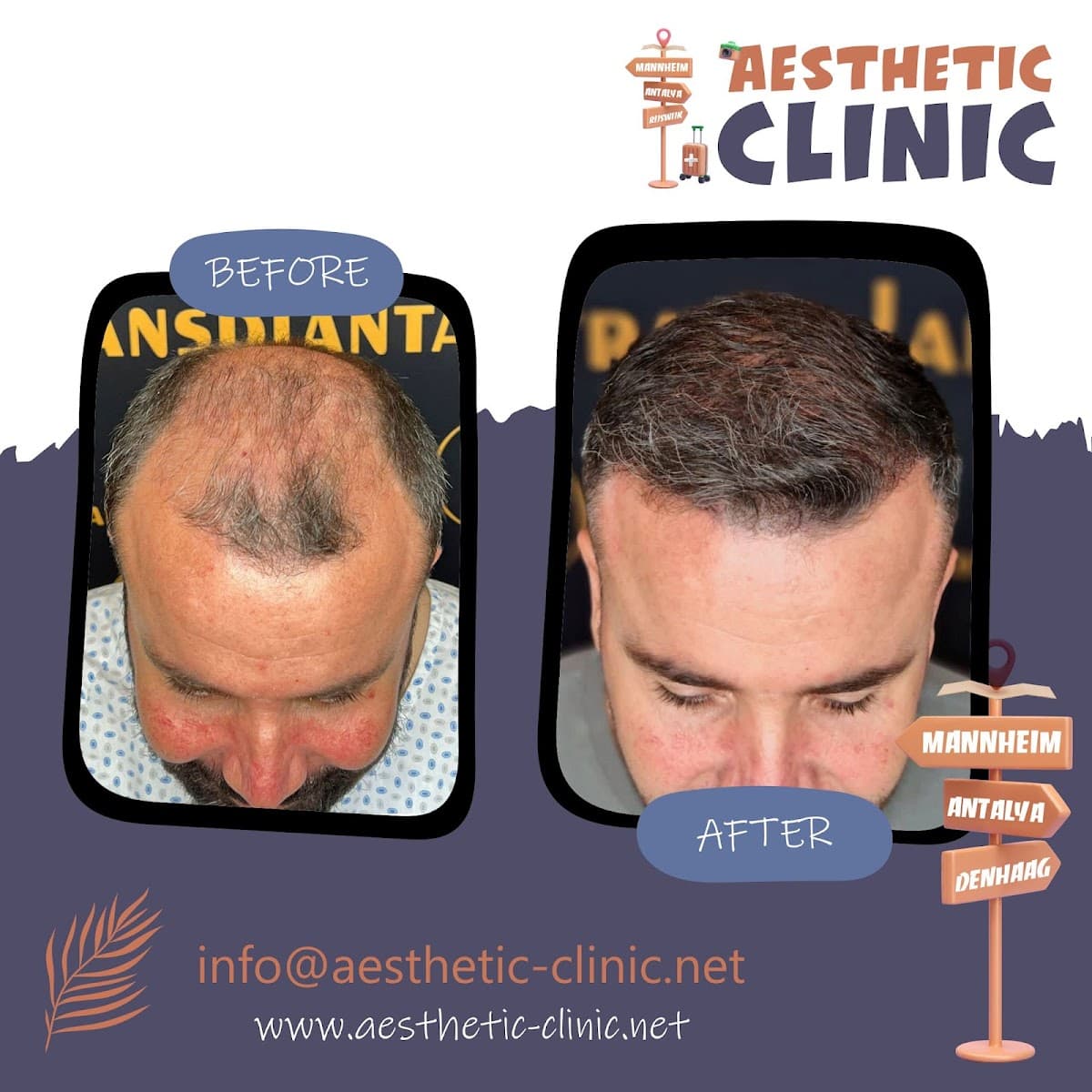 Aesthetic Clinic Antalya