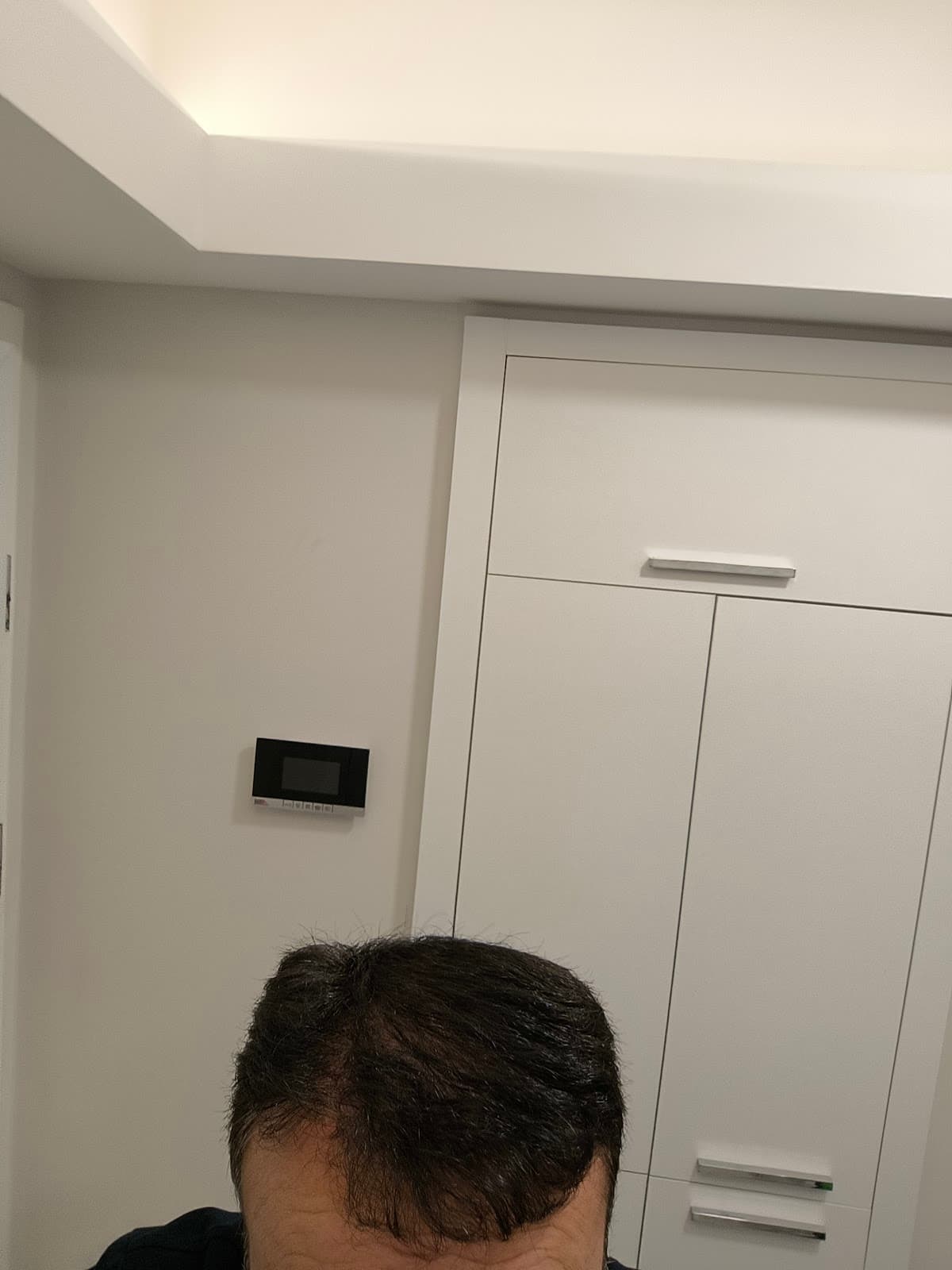 Akdeniz Antalya Saç Ekimi - Hair Transplant Antalya