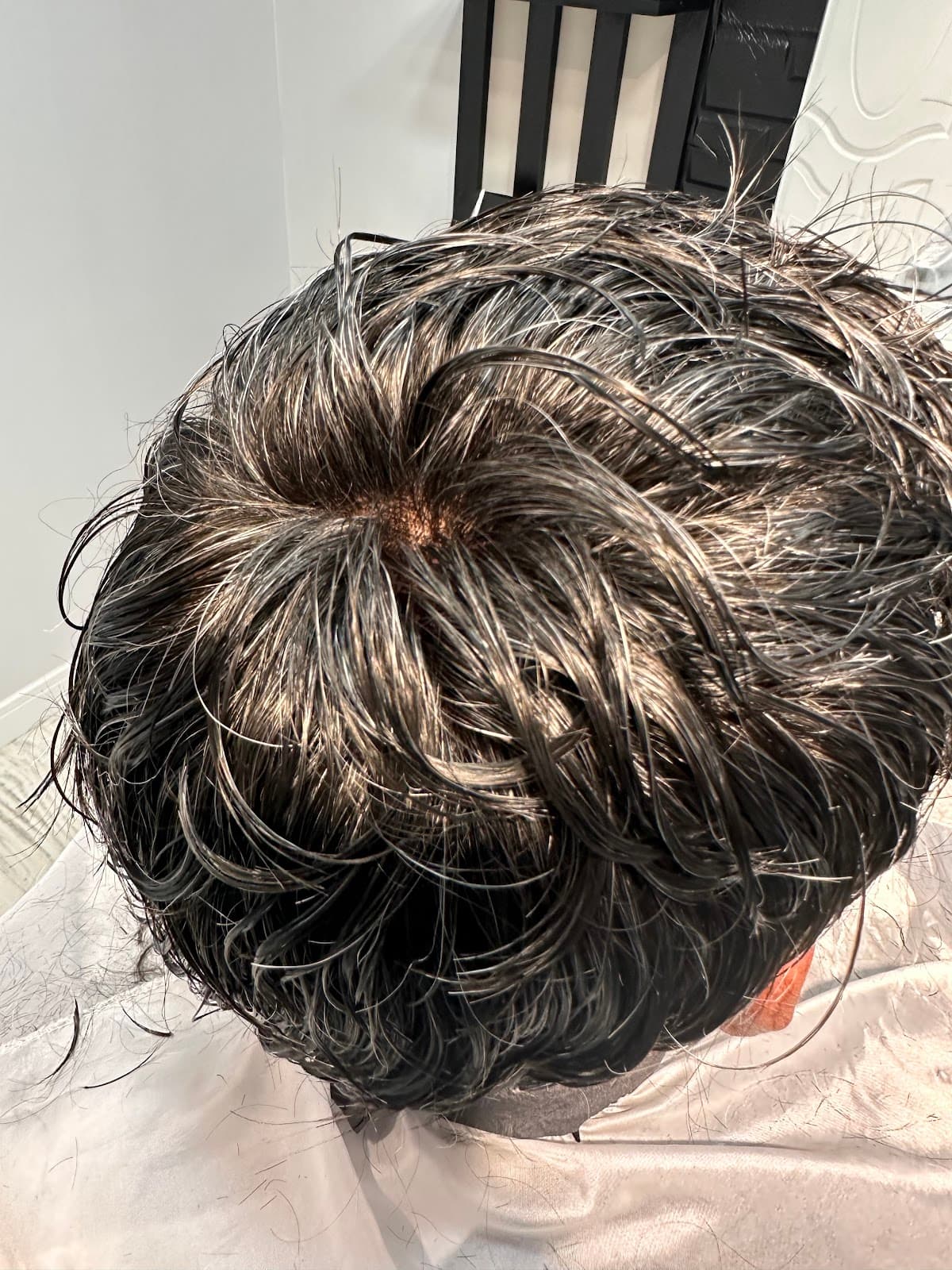 ANKARA PROTEZ SAÇ& KAYNAK SAÇ MERKEZİ (SERDAL KAYA) SKY HAİR