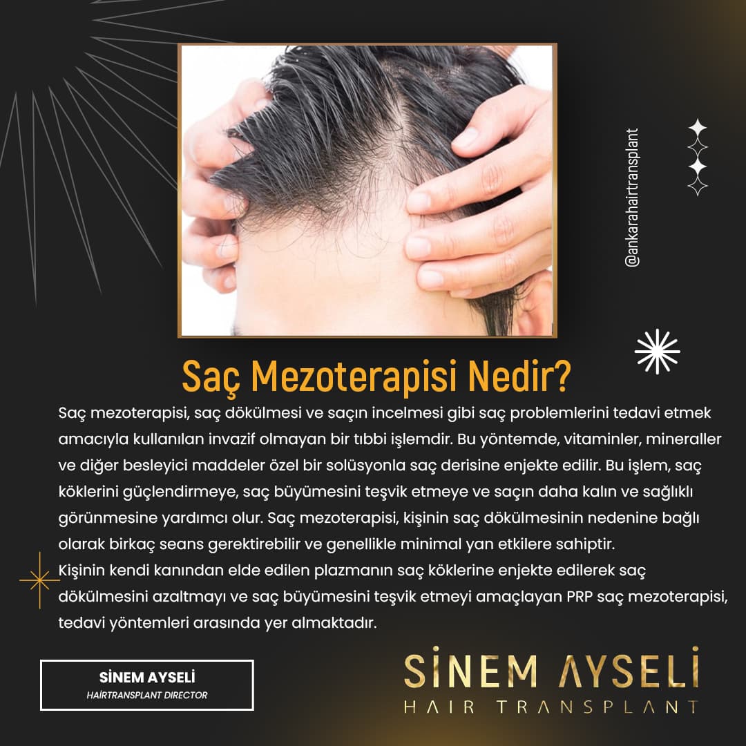 Ankara Saç Ekimi Sinem Ayseli
