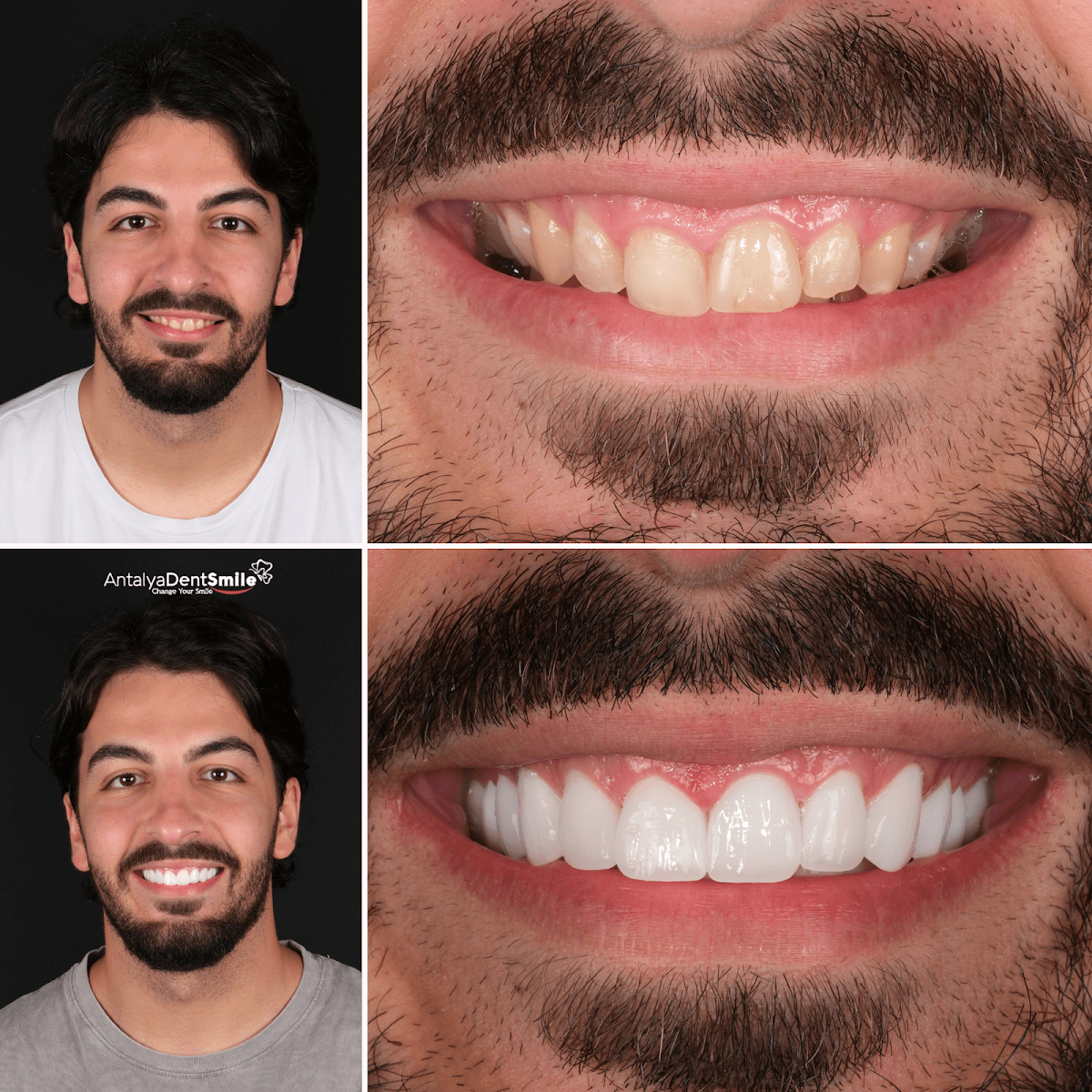 Antalya Dent Smile