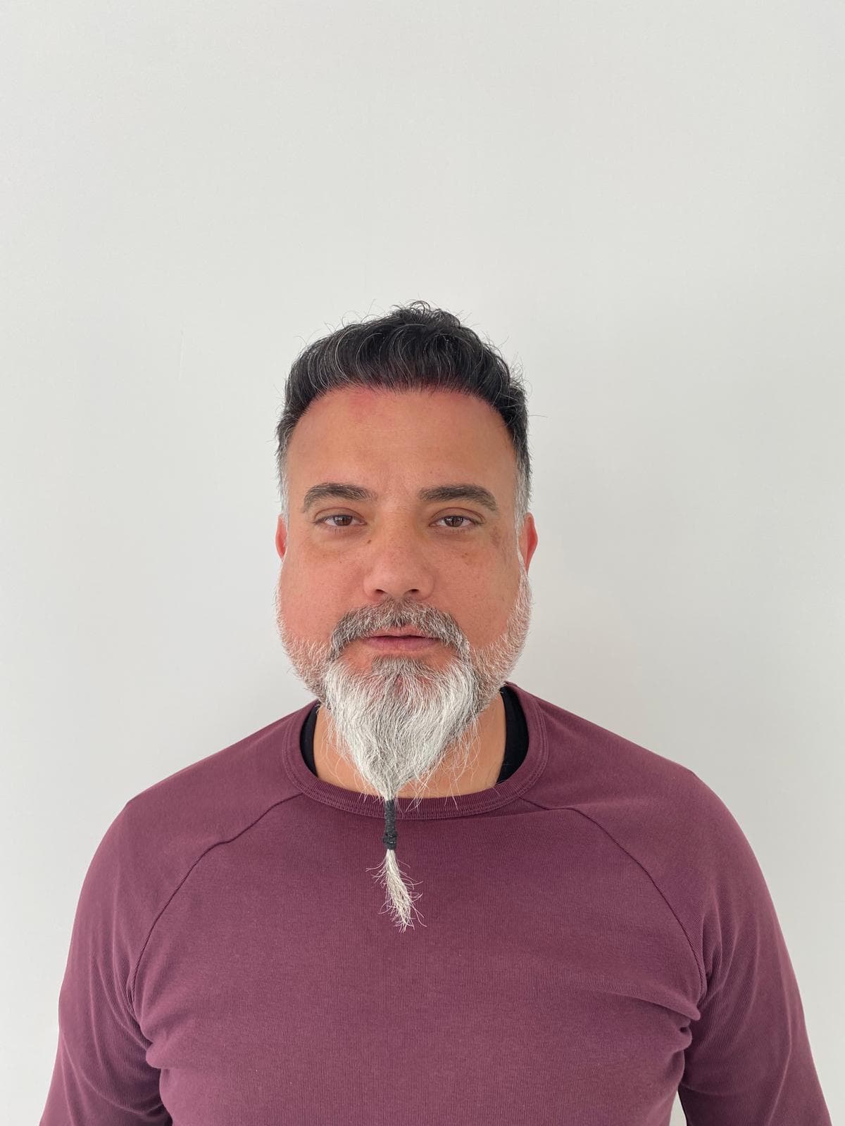 BT Hair Clinic Antalya