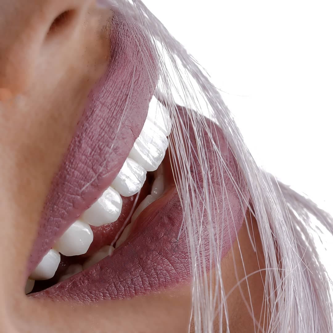 Dental Aesthetic Turkey