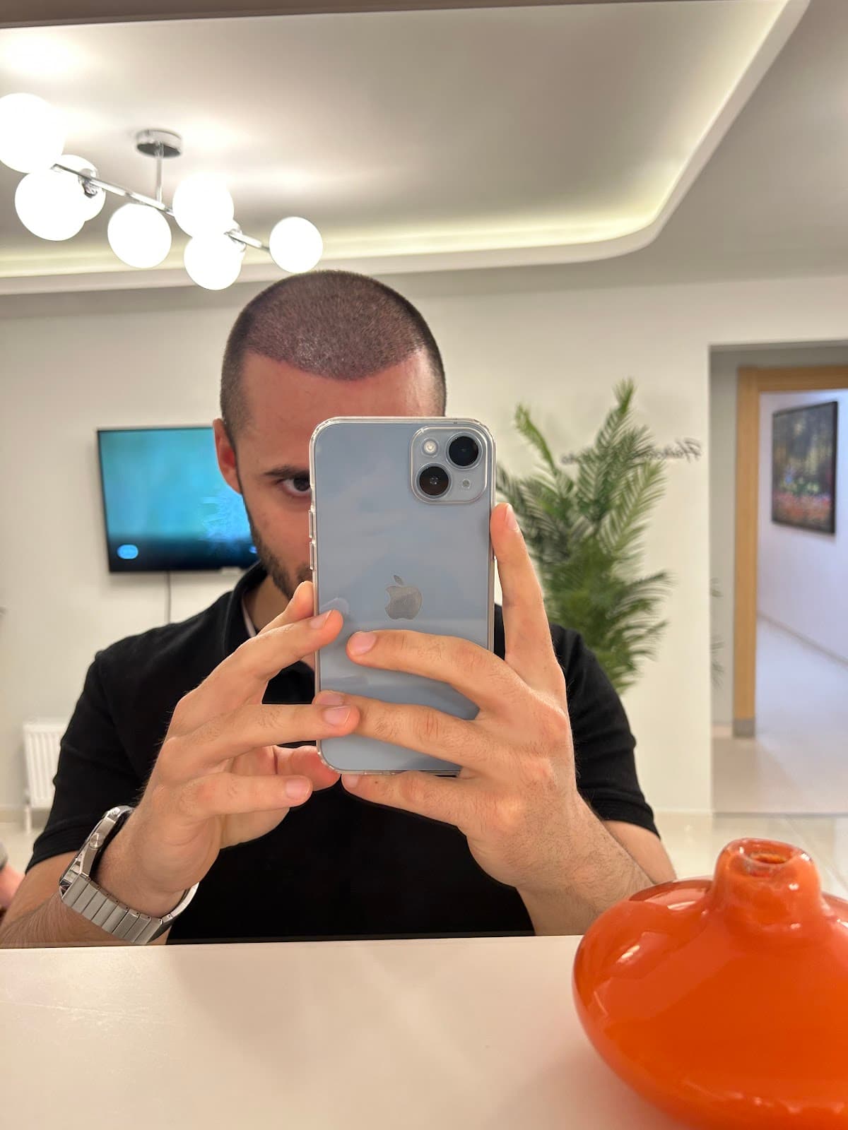 Egemen Güdül Hair Clinic Ankara Saç Ekim Merkezi Ankara