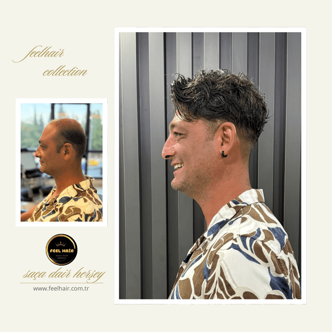 Feel Hair Protez Saç