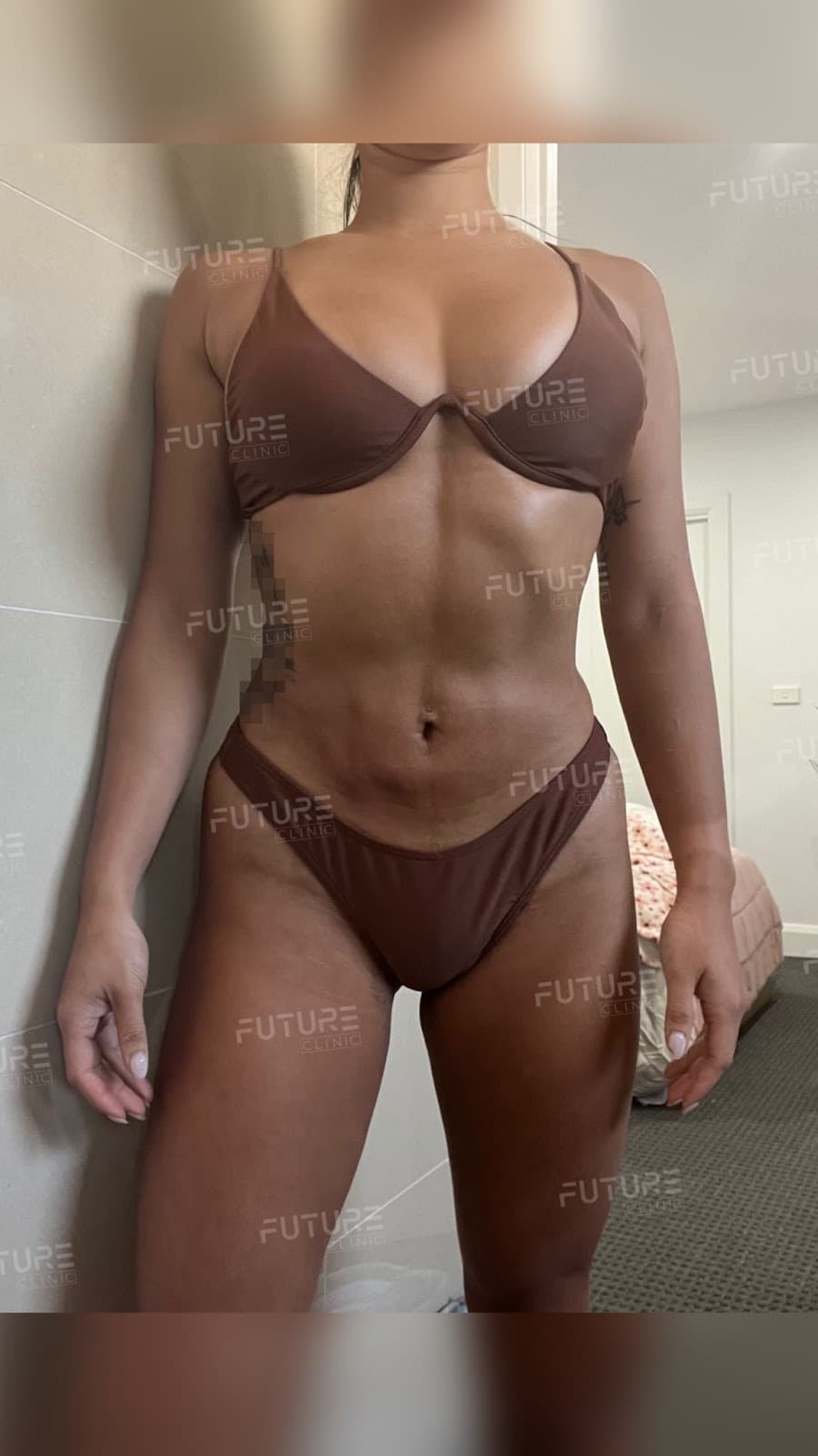 Future Clinic Turkey