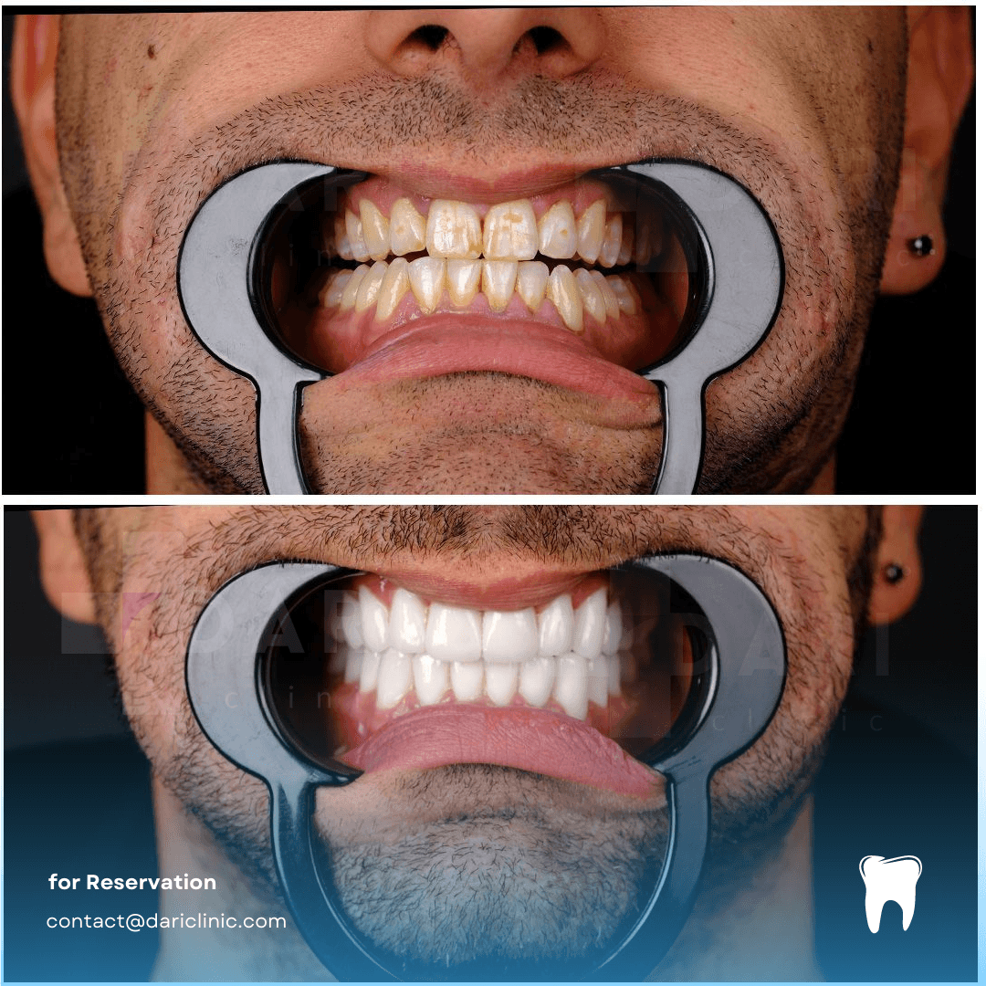 ONY Clinic - | Dental | Tummy Tuck | Hair Transplant | Aesthetic Clinic | Liposuction | Rinoplasti