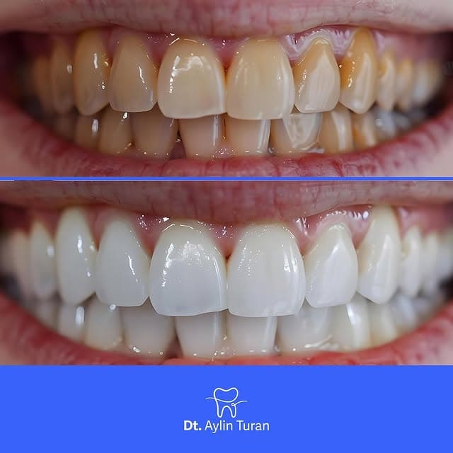 Dr. Aylin Turan - Photo 5