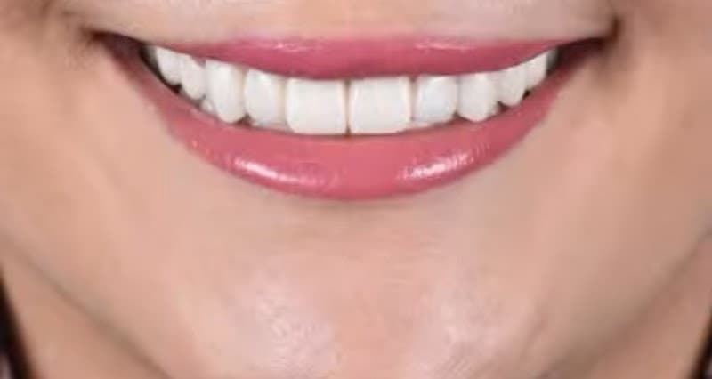 Dr. Uğur Gültekinler - Photo 2