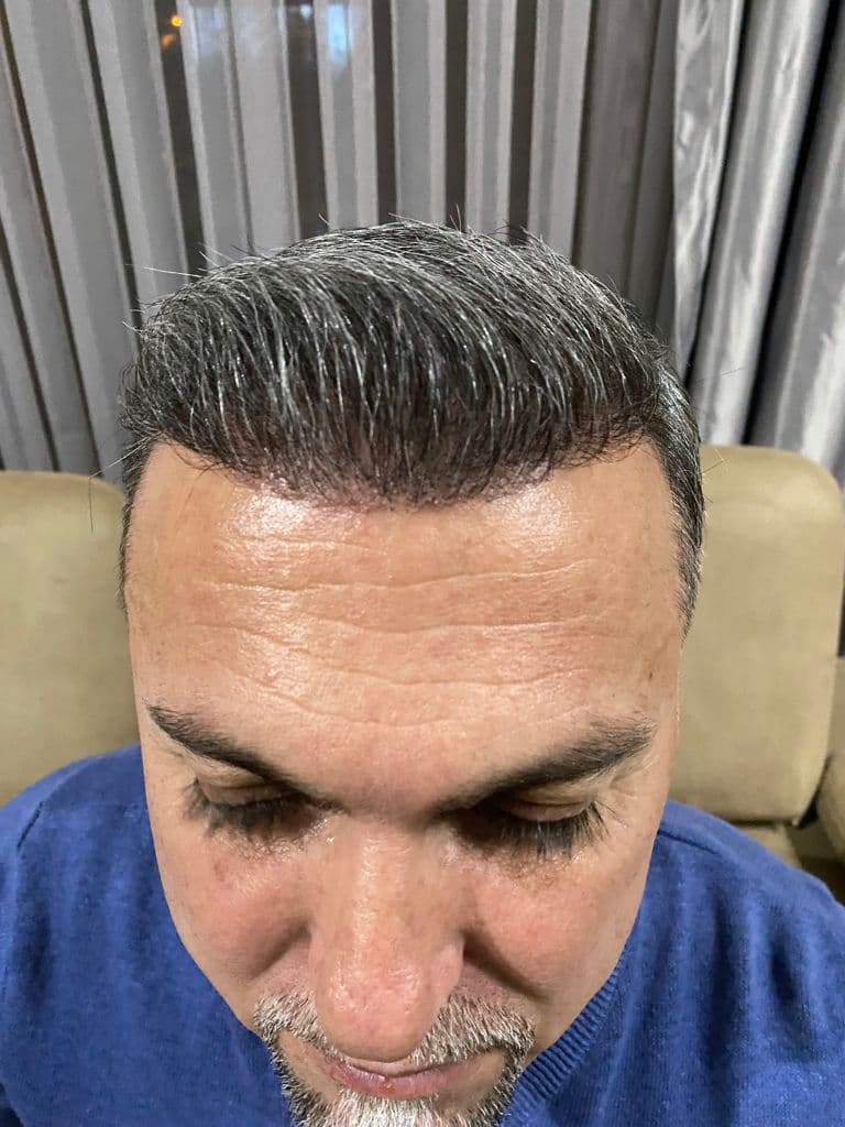 Op. Dr. Hakan Doğanay