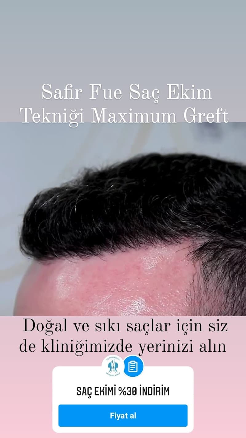 Op. Dr. Muhammet Erkan